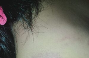 Diduga Menjadi Korban Penganiayaan Pengasuh Pondok, Santriwati Di Kubu Raya Ini Alami Trauma